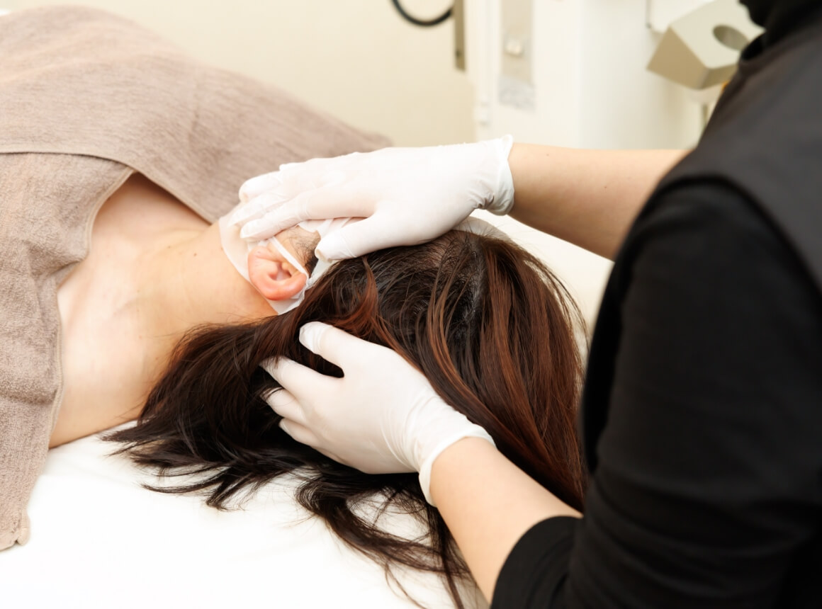 頭皮環境からアプローチ